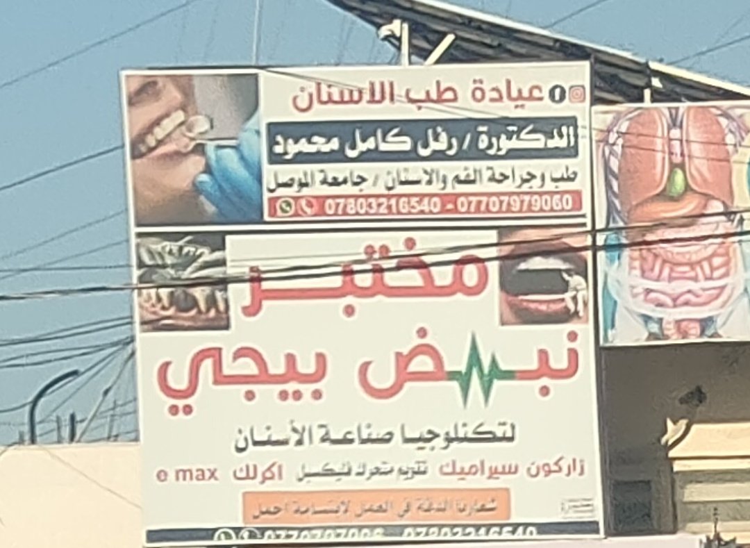 مختبر نبض بيجي